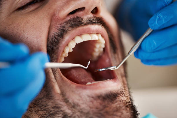 Best Mobile Emergency Dentist in Mascoutah, IL